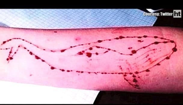 काय आहे हा ब्लू व्हेल गेम? आणि मुलं हा गेम खेळून आत्महत्या का करत आहेत?