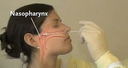 काही कोरोना रुग्णांची चाचणी पॉझिटिव्ह असूनही निगेटिव्ह का येत आहे ?