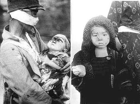 कसे उभे राहिले हिरोशिमा अशा सुलतानी संकटातून?