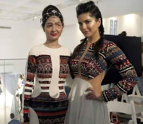 अॅसिड अटॅक होऊनही तिने केला अमेरिकेत रॅम्प वॉक! : सलाम रेश्मा कुरेशी!!