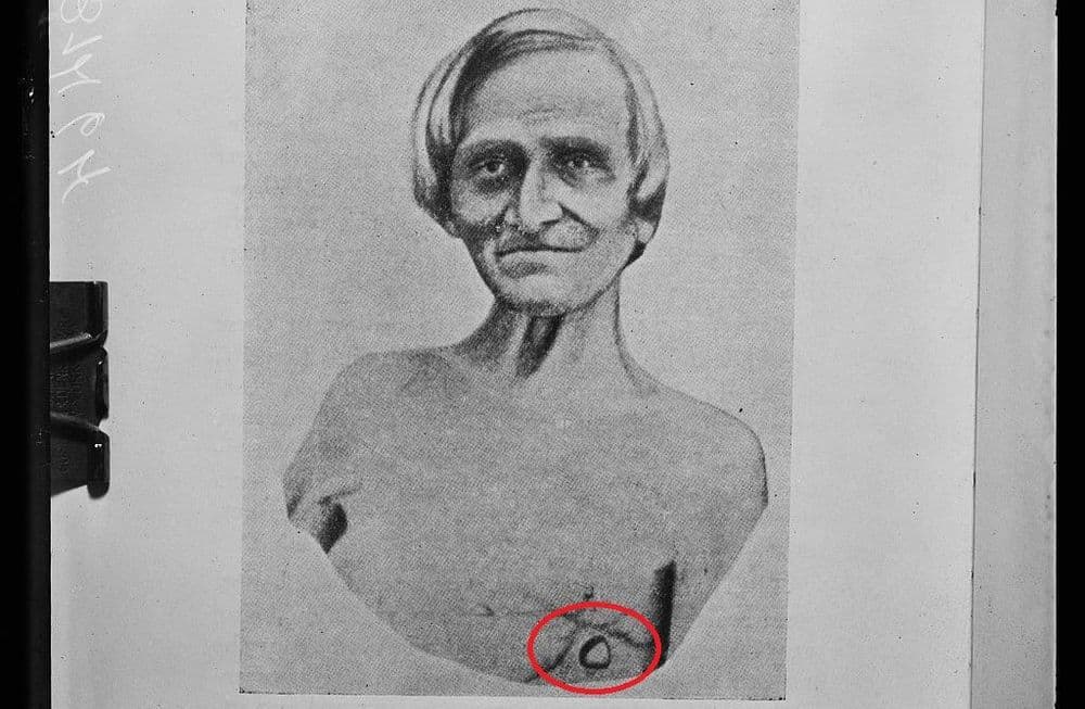 बंदुकीच्या गोळीने पोटाला छिद्र पडलं आणि रसायनशास्त्राचा इतिहासच बदलला !!