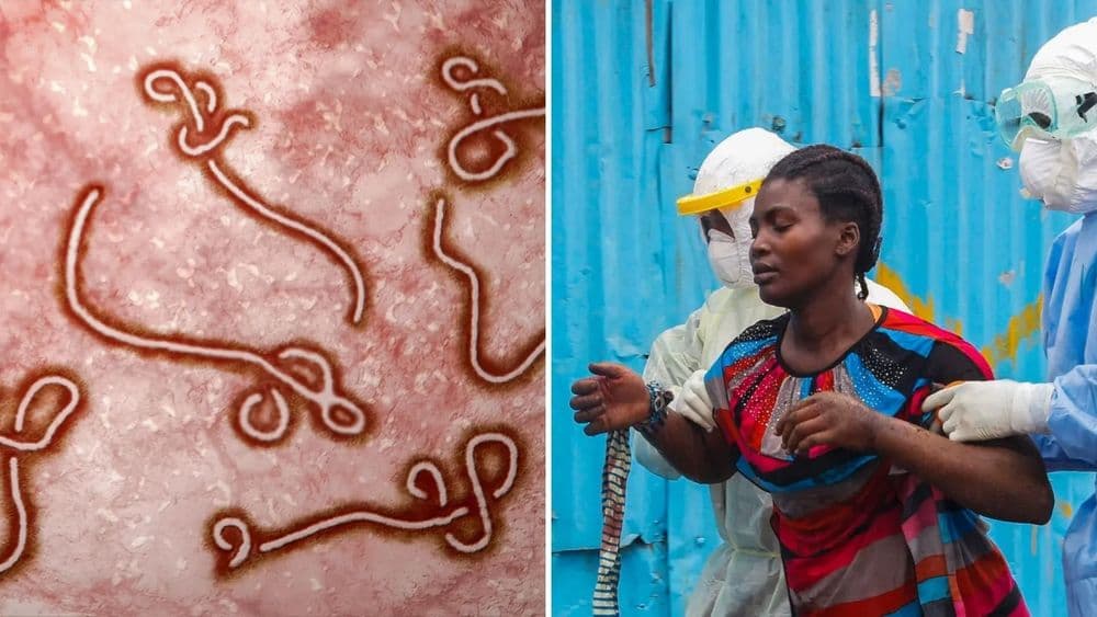 इबोला काय आहे? वाचा १९७६ साली सापडलेल्या या विषाणूचा आजवरचा प्रवास !!