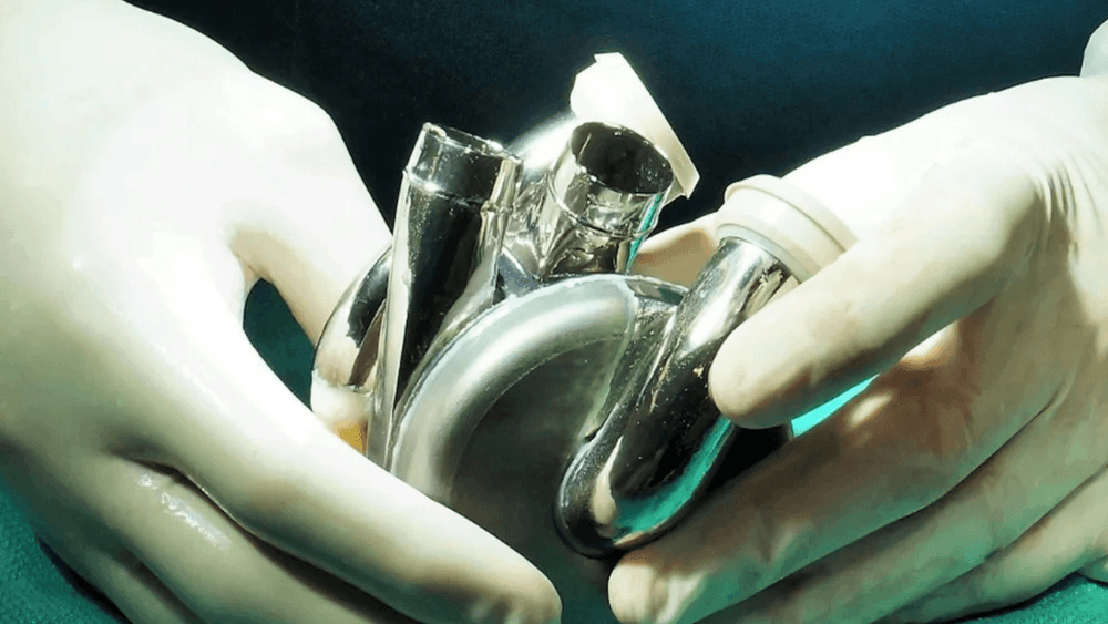 हे टिटॅनियम मेटलचे हार्ट अनेकांना जीवदान देणार !