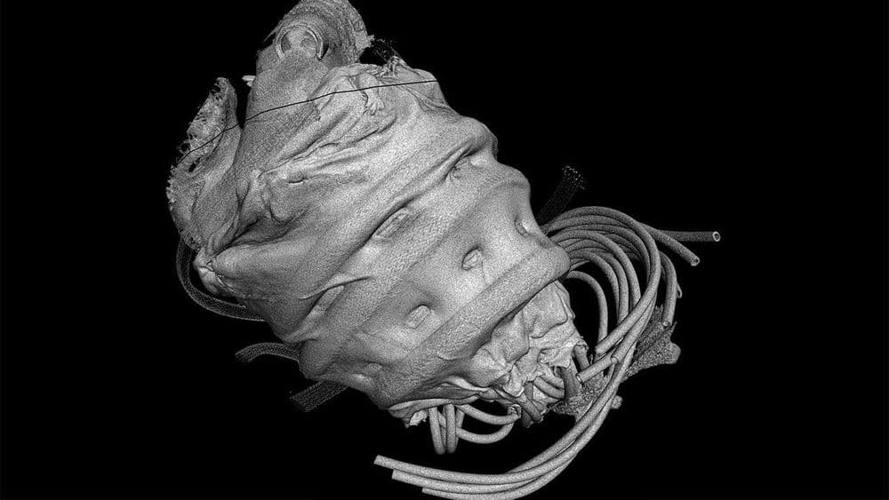हार्टफेलसाठी स्मार्ट शीटचा उपाय