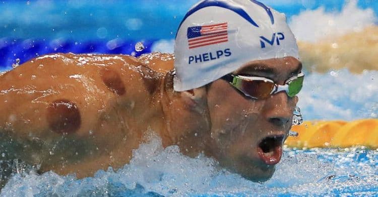 ऑलिंपिक २०१६ : फेल्प्स आणि इतर खेळाडूंच्या अंगावरच्या जांभळ्या डागांचं रहस्य उलगडलं..