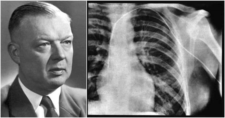 स्वतःच्याच हृदयावर प्रयोग  करून कार्डिओलॉजीचा पाया रचणाऱ्या डॉ. वर्नर फोर्समनची गोष्ट !!