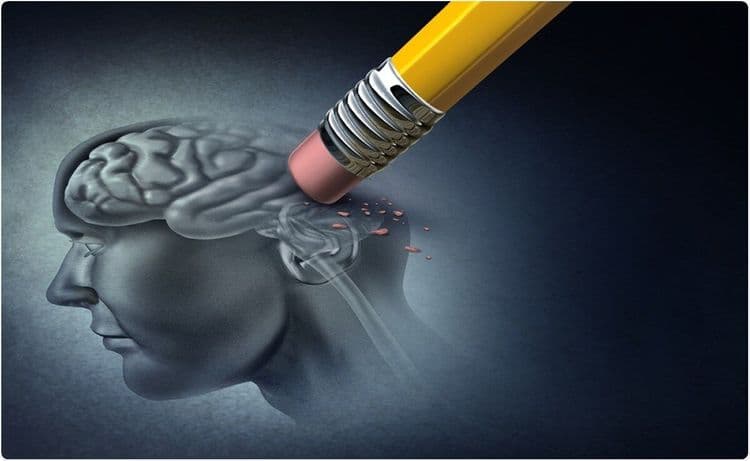 अजूनही शास्त्रज्ञांच्या पूर्णपणे आवाक्यात न आलेला विकार-अल्झायमर!! त्याची कारणे, निदान, परिणाम आणि उपचारांबद्दल तर जाणून घ्या.