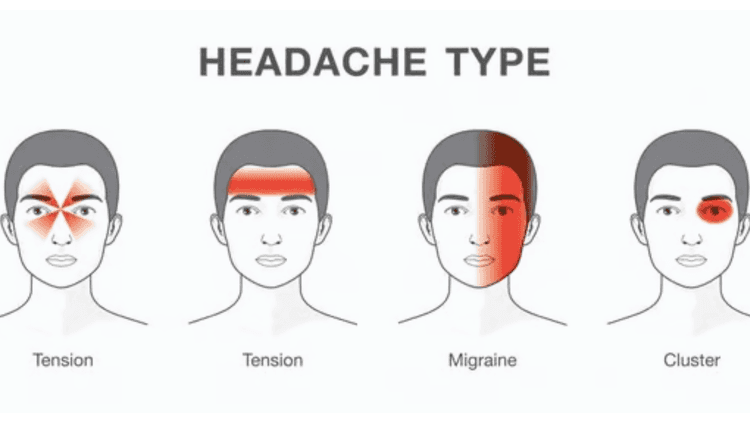 अर्धशिशिची लक्षणे 