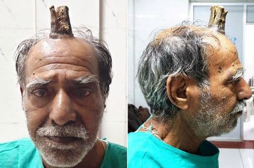 शेतकऱ्याच्या डोक्यावर उगवलं शिंग ? बातमी खरी की खोटी ?