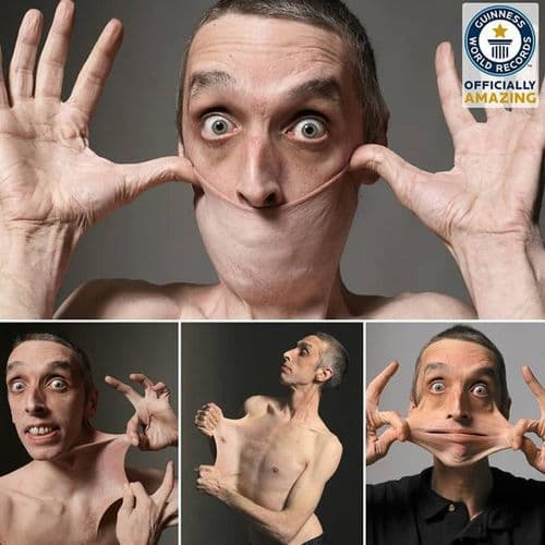 ५. गेरी टर्नरने ताणलेल्या त्वचेचा विक्रम केला आहे.