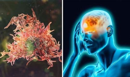 मेंदू पोखरणारा अमिबा म्हणजे नक्की काय?