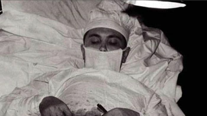 स्वतःच स्वतःच्या अपेंडिक्सचं ऑपरेशन करणारा डॉक्टर !!