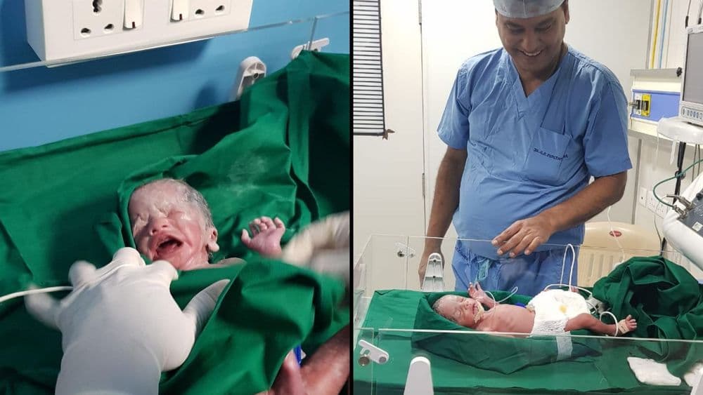 गर्भाशय प्रत्यारोपणातून पुण्यात जन्मली आशिया खंडातली पहिली मुलगी !!