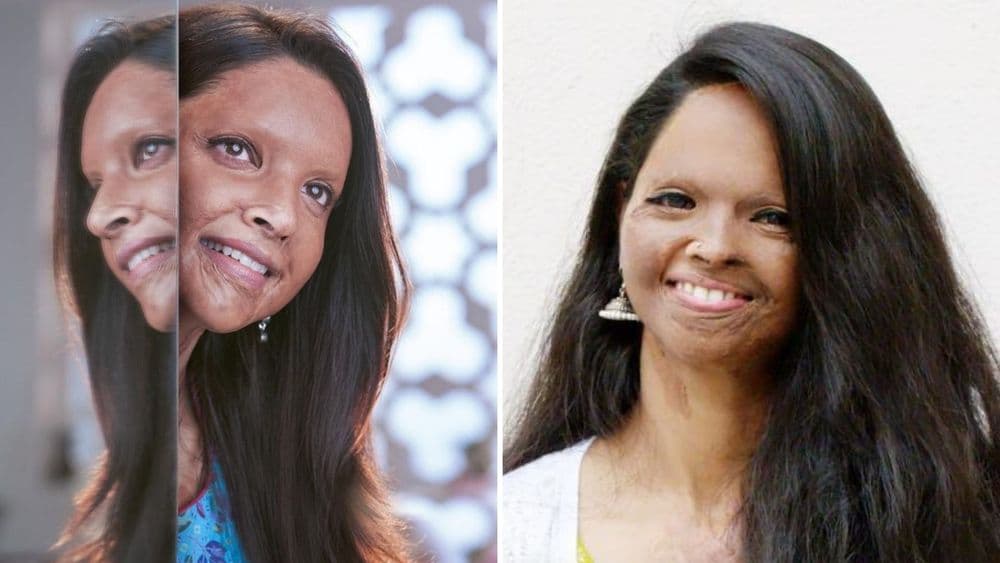 इतक्या ऍसिड बळीमधून फक्त लक्ष्मीवरतीच सिनेमा का ? जाणून घ्या !!