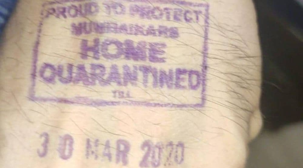 सरकार काही लोकांच्या हातावर हा शिक्का मारत आहे,  या शिक्क्याचा अर्थ काय?