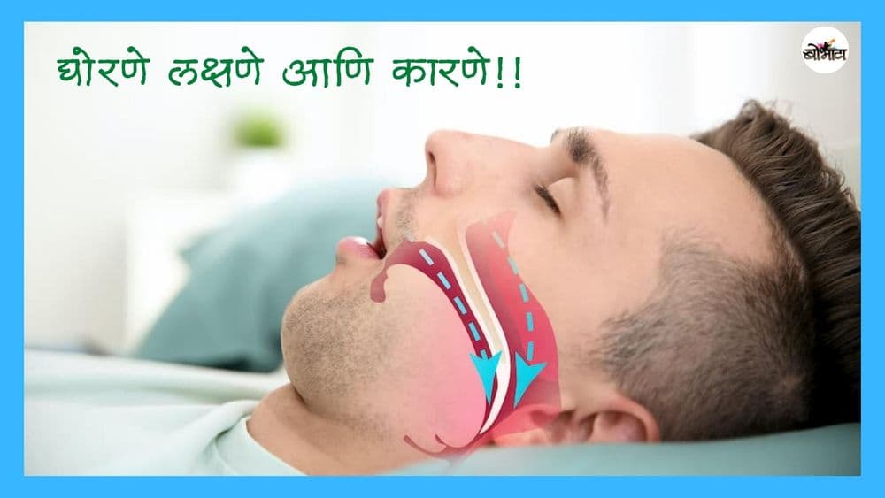 माणूस का घोरतो? ते कमी कसं करता येतं? घोरण्याचा आणि वयाचा काही संबंध असतो?