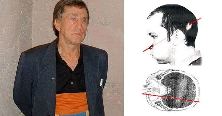 या माणसाच्या मेंदूतून  प्रकाशाच्या वेगाने चक्क प्रोटॉन्स गेले आणि तरीही तो जिवंत आहे!!