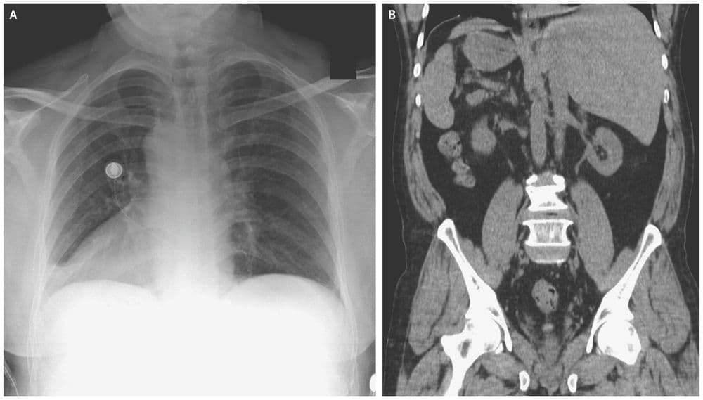याच्या शरीरातले अवयव वेगळ्याच ठिकाणी आहेत.. असं कशामुळे होतं?