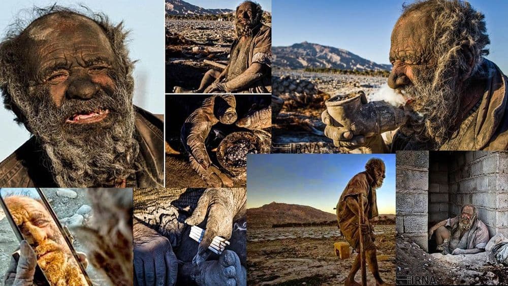६७ वर्षात एकदाही आंघोळ न केलेला जगातला सर्वात घाणेरडा माणूस जगतो तरी कसा?