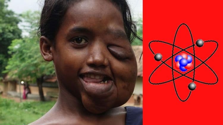 जादूगुडातील किरणोत्सर्गाचे बळी...वाचा भारताच्या युरेनियम खाणीचे काळे सत्य !!