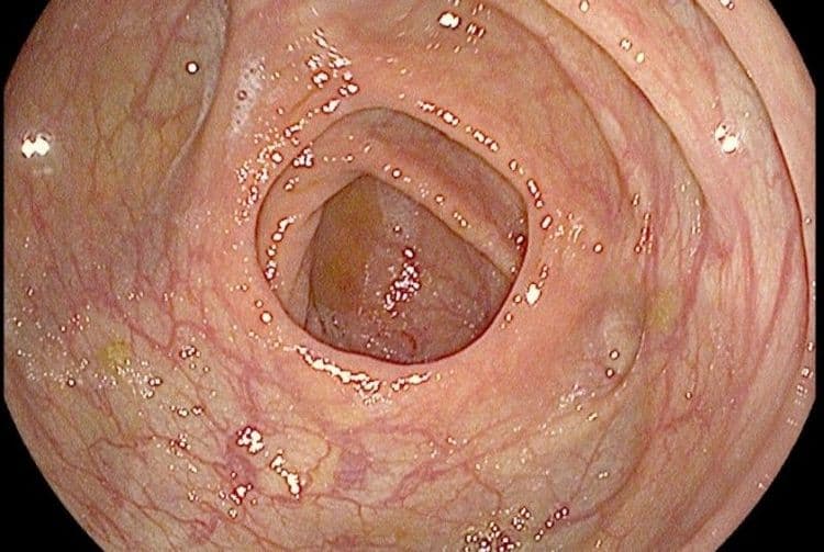 पादणं आपल्या आतड्यांसाठी खूप चांगलं आहे..